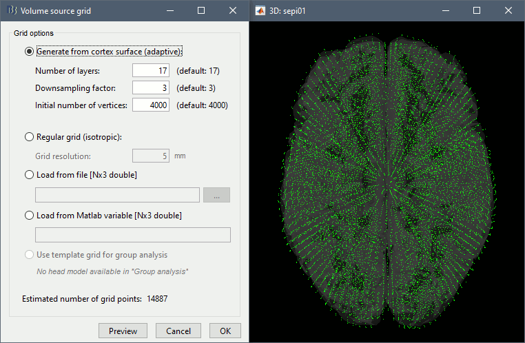 headmodel_vol3.gif