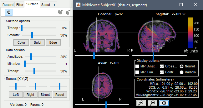 anat_overlay.gif