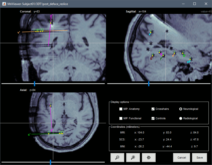 display_mri.gif