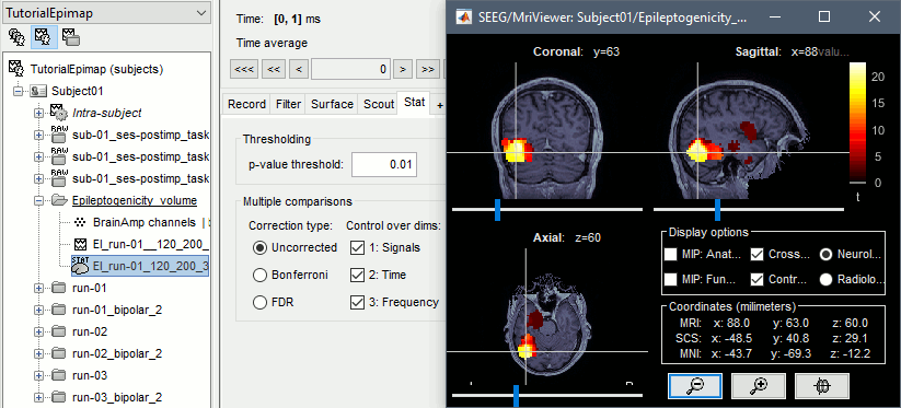 epilepto_map_sz1.gif