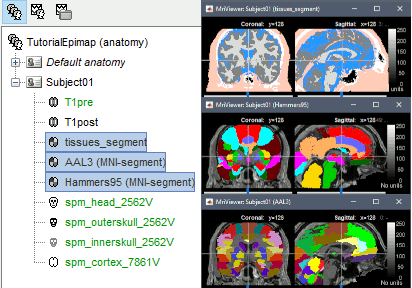 mni_aal3.gif