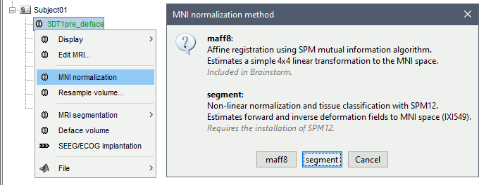 mni_segment.gif