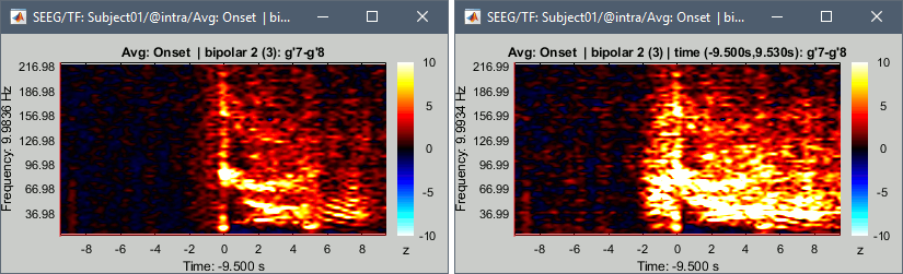 timefreq_adv_compare.gif