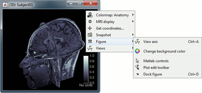 mri_3d.gif