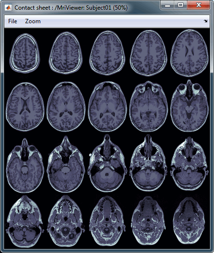 mri_axial.gif