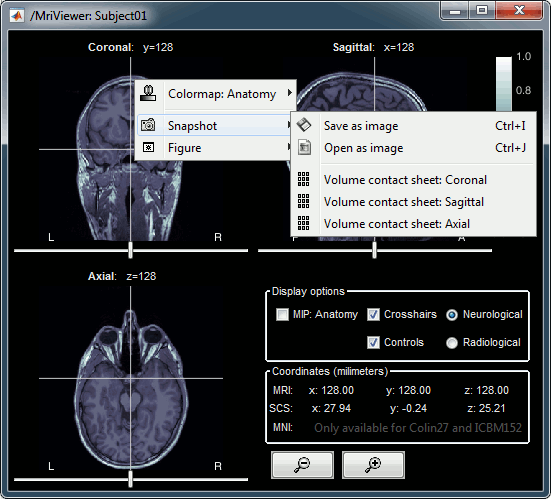 mri_viewer.gif