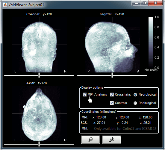 mri_viewer_mip.gif