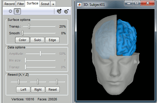 surface_options.gif