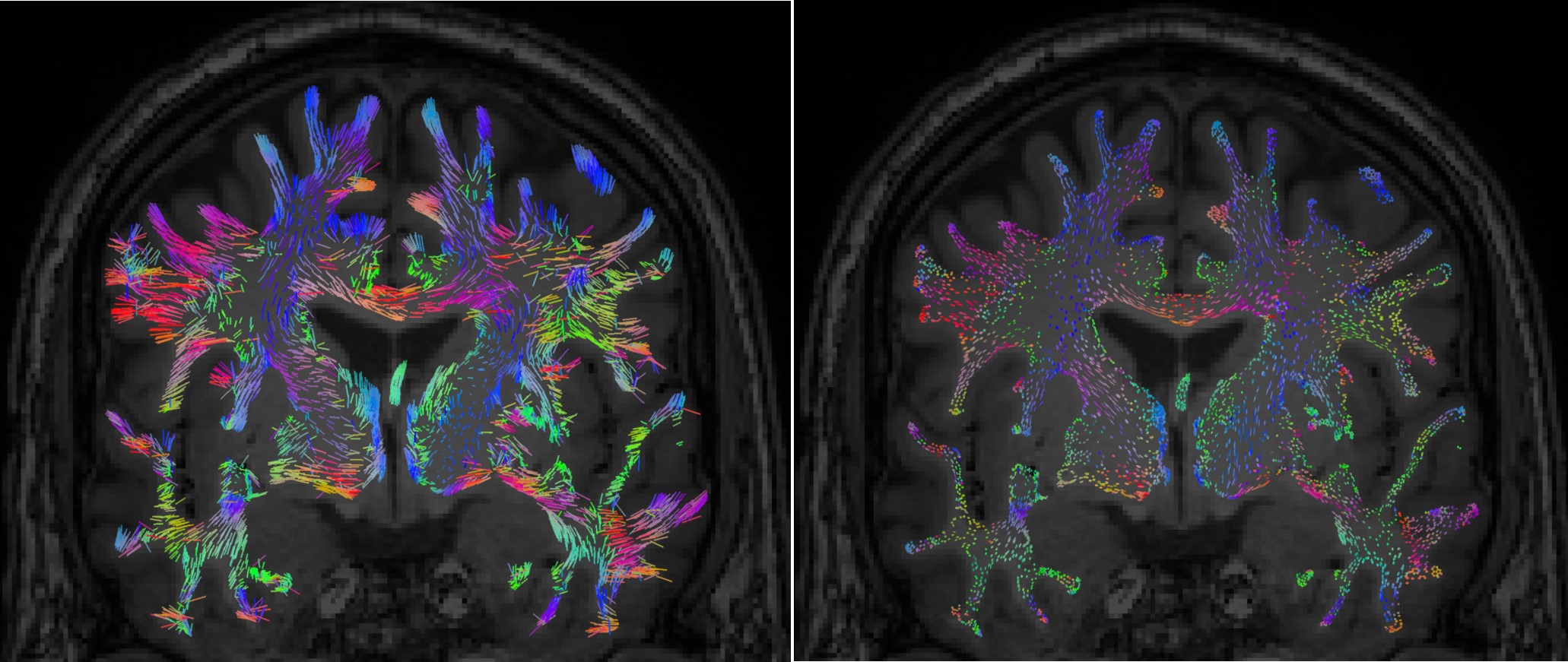 tensorsOnMRI.jpg