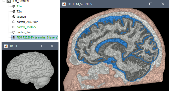 simnibs2.gif