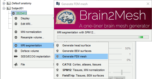 femMesh1.gif