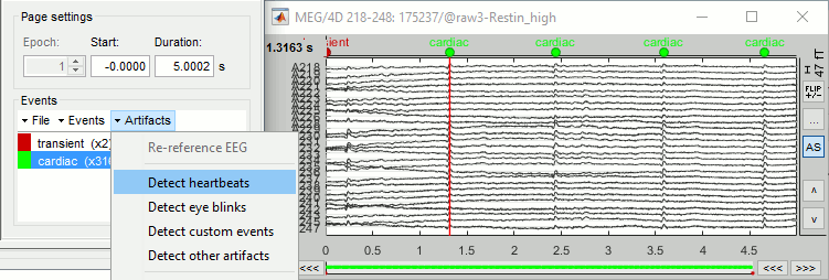 ecg_detect.gif