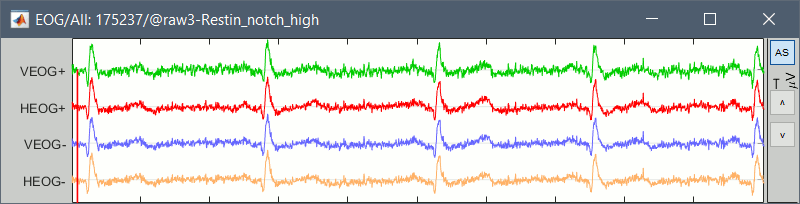 eog_bipolar.gif