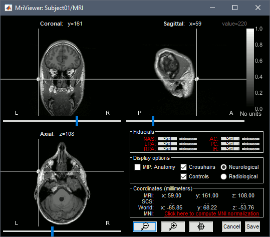 import_anat_marker.gif