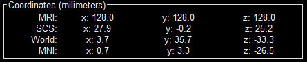 mni_coordinates.gif