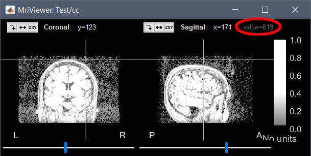 mriValue.gif