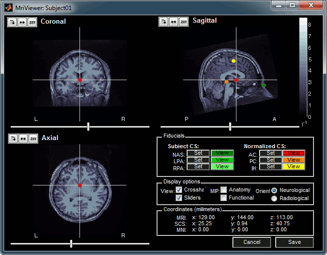 mriviewer.gif