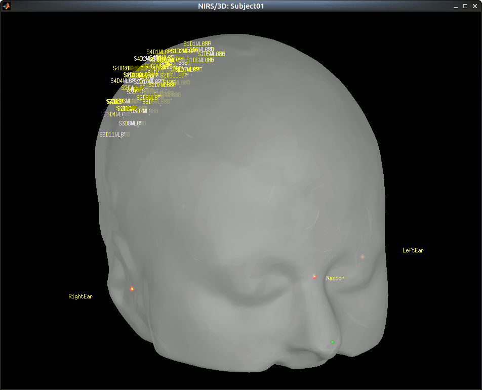 NIRSTORM_tut1_display_sensors_fiducials.gif