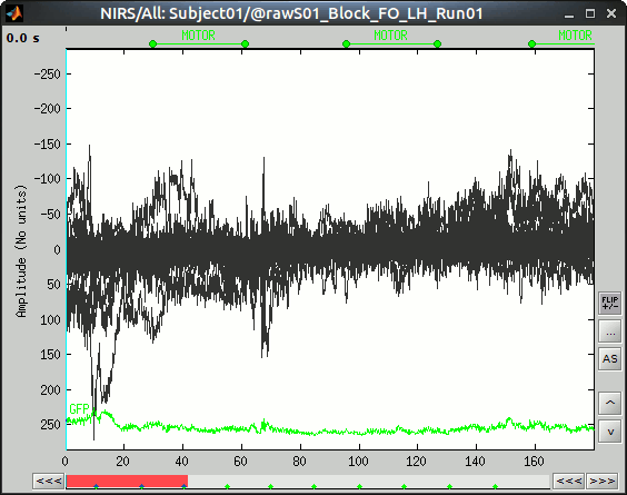 NIRSTORM_tut2_nirs_time_series_motor_events.gif