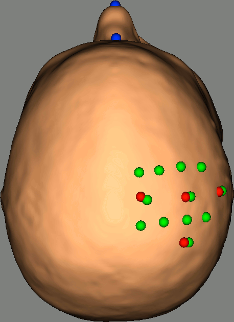 NIRSTORM_tut_nirs_tapping_brainsight_head_mesh_fiducials_3.gif