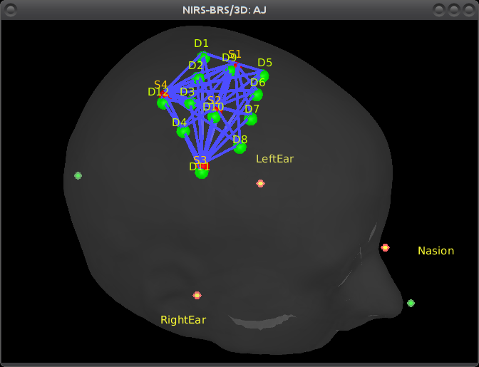 NIRSTORM_tut_nirs_tapping_display_sensors_fiducials.png