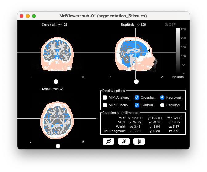figure48.png