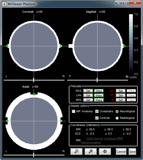 phantom_mri.gif