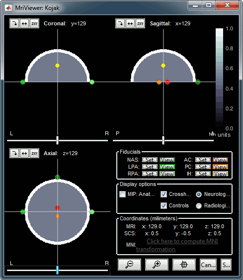 phantom_mri.gif