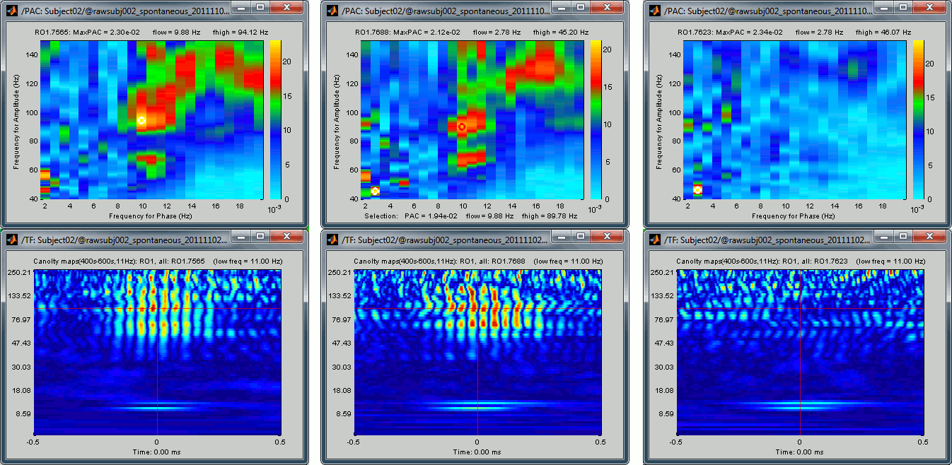 canolty_comparison.gif