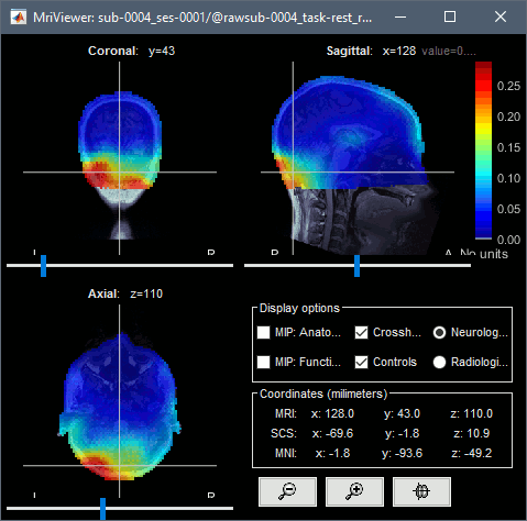 psd_volume_gamma.gif