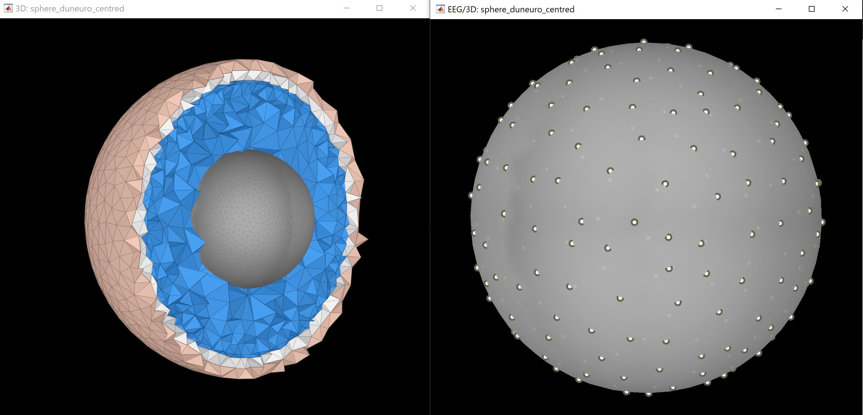 anisoHeadModel_sphere.JPG