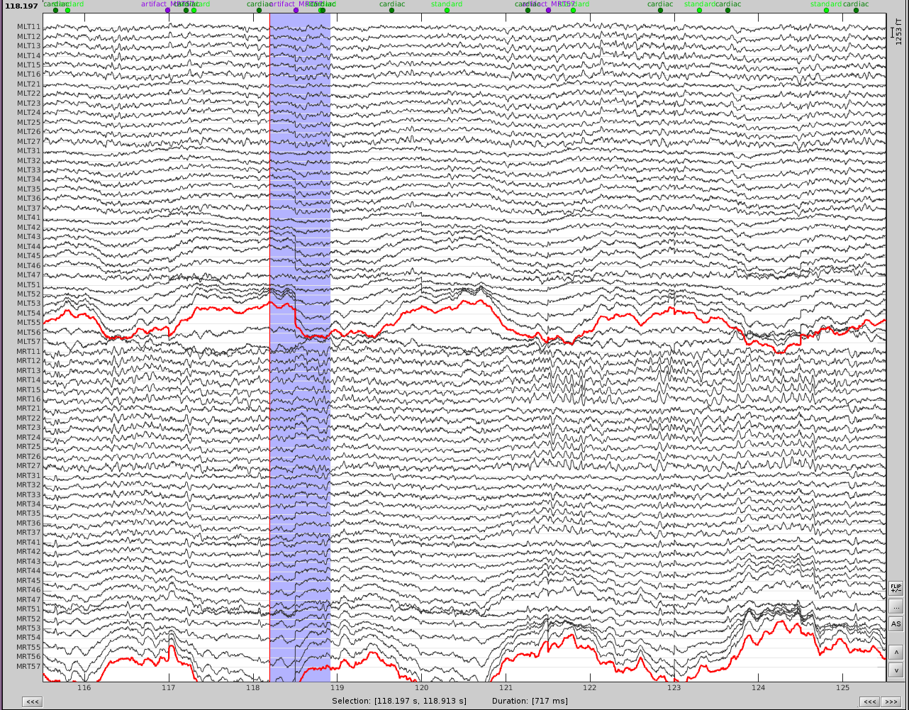 dental_and_sensor_artifacts.png