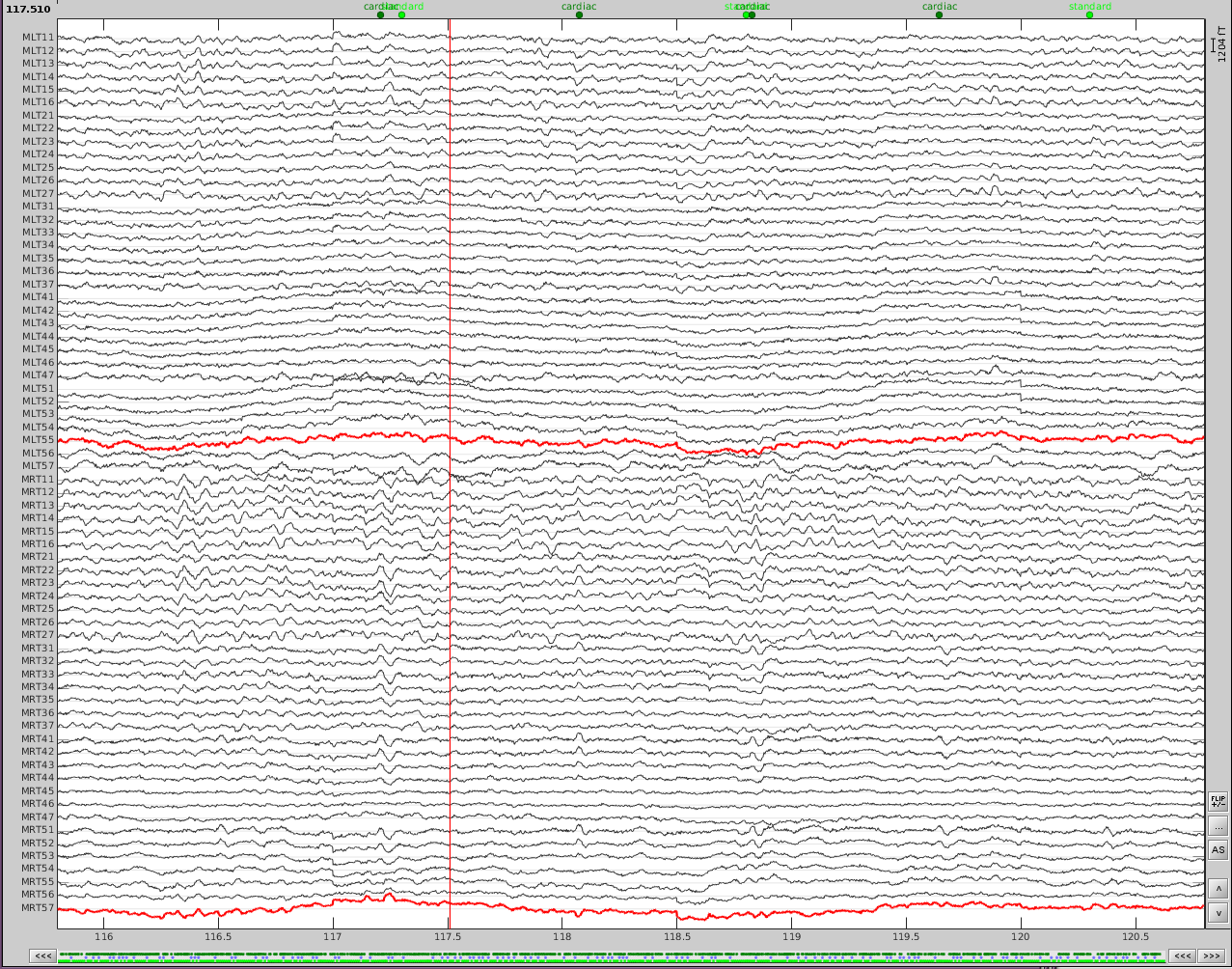 dental_and_sensor_artifacts_cleaned.png