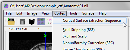 opencorticalsurface.png