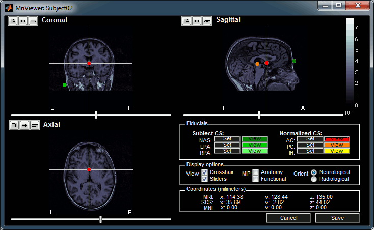 mriviewer.gif