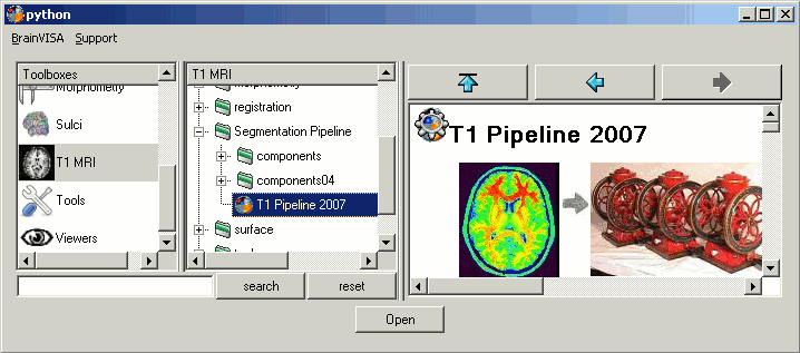 selectT1Pipeline.gif