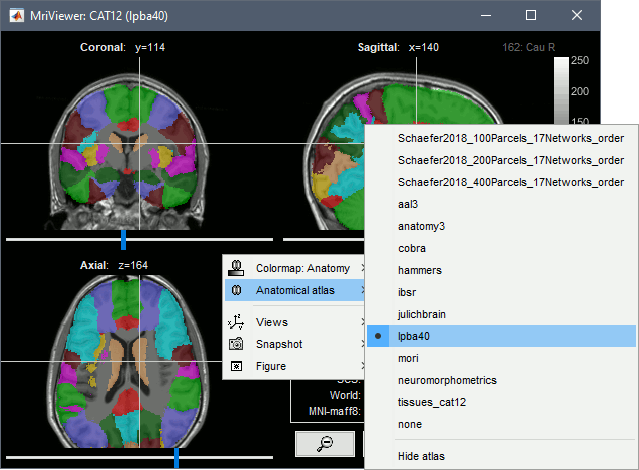 volatlas.gif