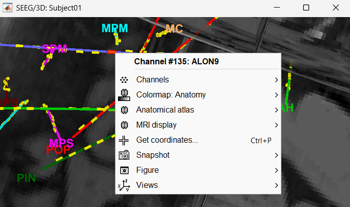 25_display_selectchan.png