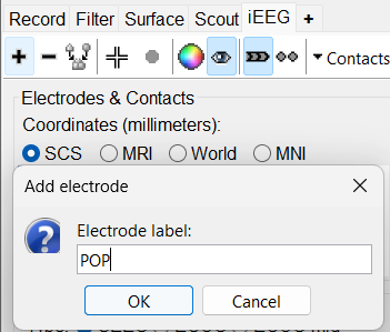 31_add_electrode_ask.png
