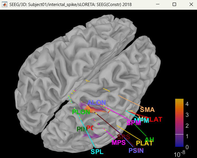 64_view_inv_model_cortex.png