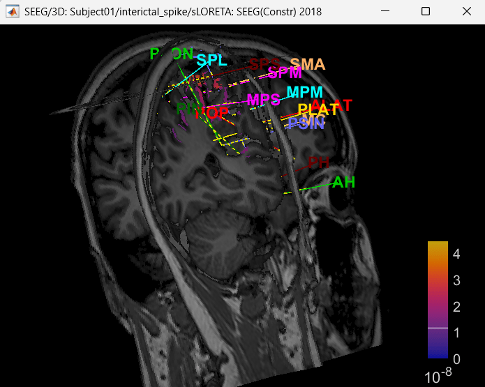 65_view_inv_model_mri3d.png
