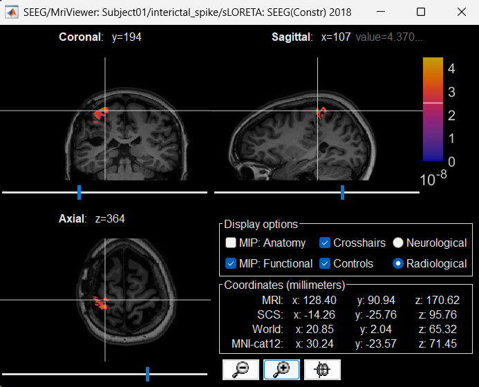 66_view_inv_model_mri.png