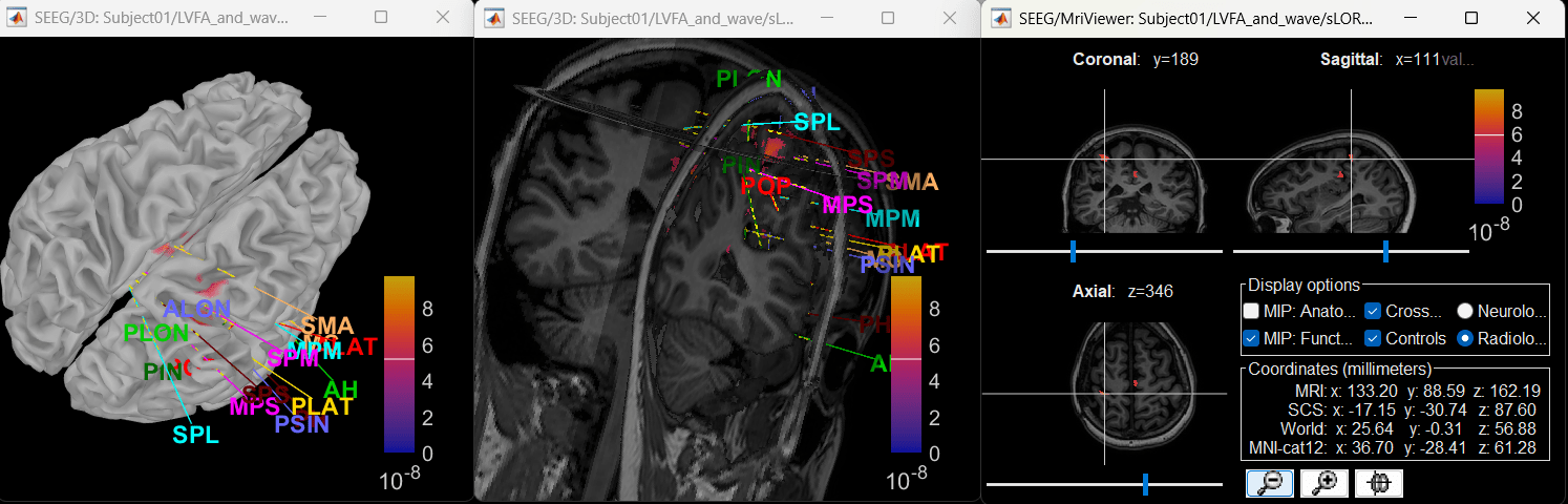 70_view_inv_model_wave.png