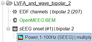 71_time_freq_decomp_lvfa3.png