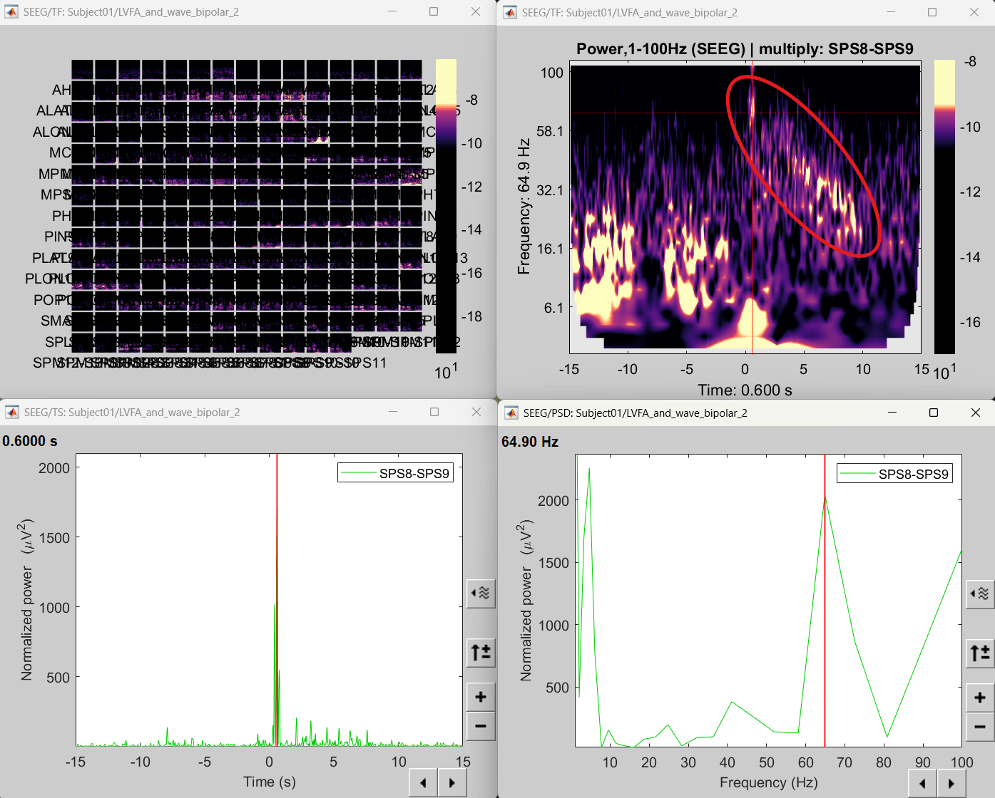 72_time_freq_map_lvfa.png