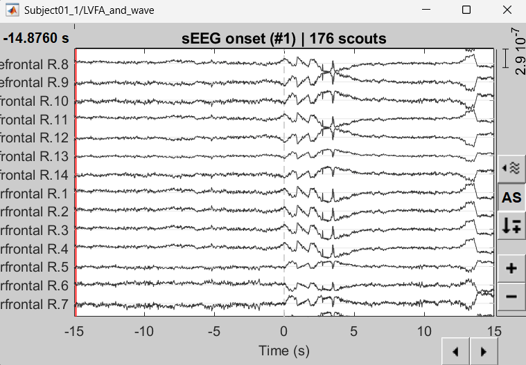 75_scout_time_series_lvfa2.png