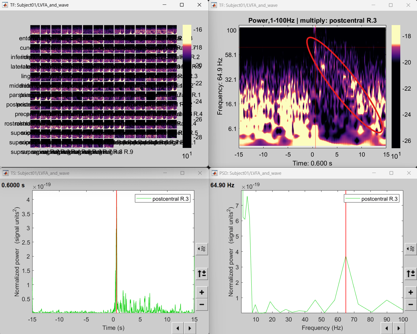 76_time_freq_map_lvfa2.png