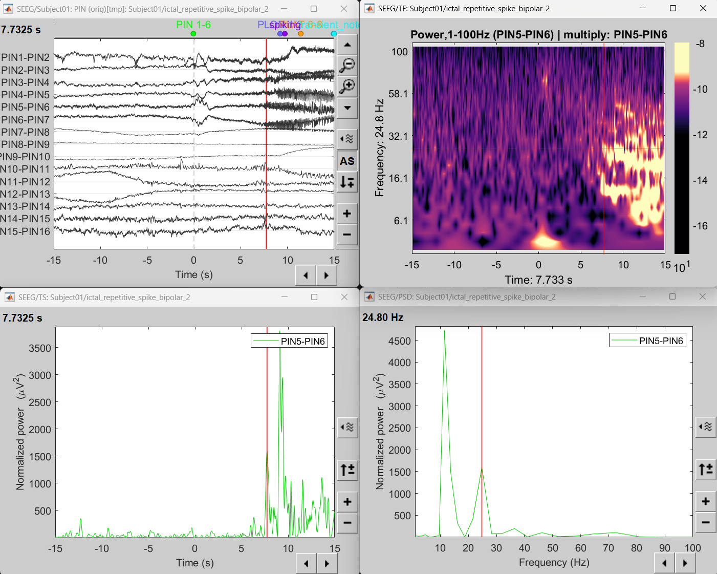 79_time_freq_map_ictal.png