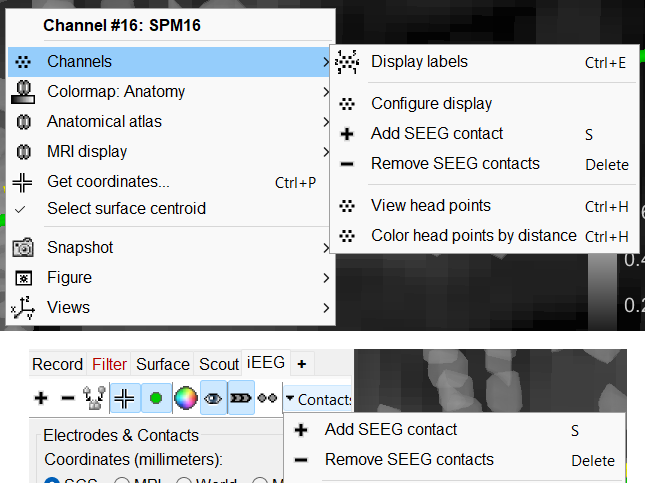 82_add_remove_contacts.png