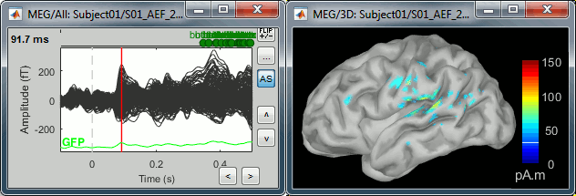 display_cortex.gif